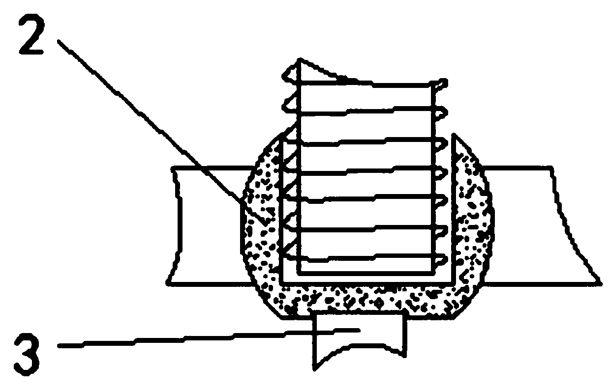 Low-temperature antibacterial treatment and nursing rehabilitative apparatus for incision wound of patient