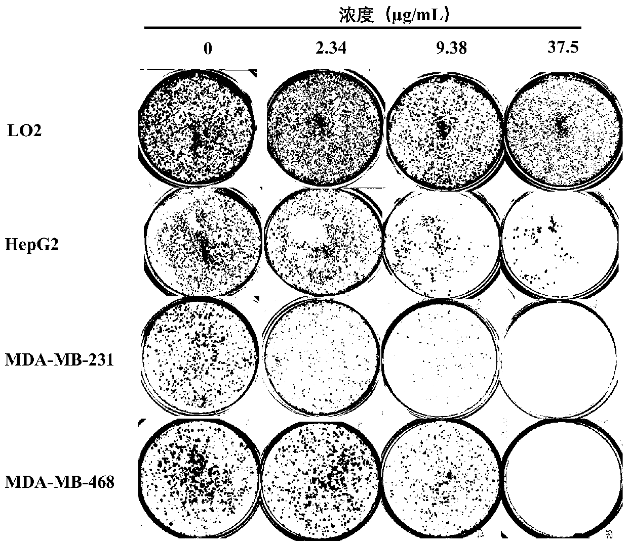 Application of pharmaceutical composition in preparation of drugs for treating cancers