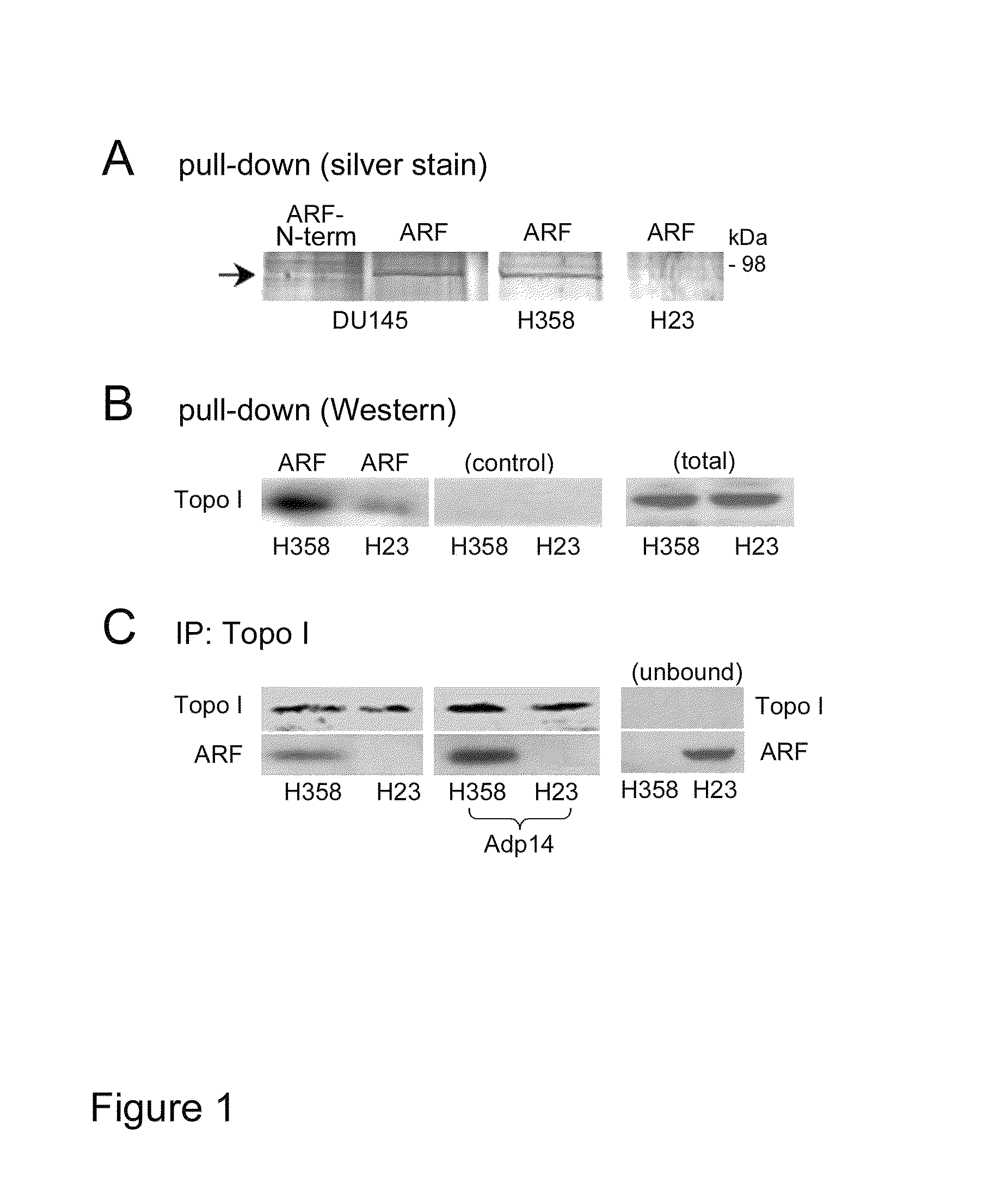 Methods and compositions for topoisomerase I modulated tumor suppression