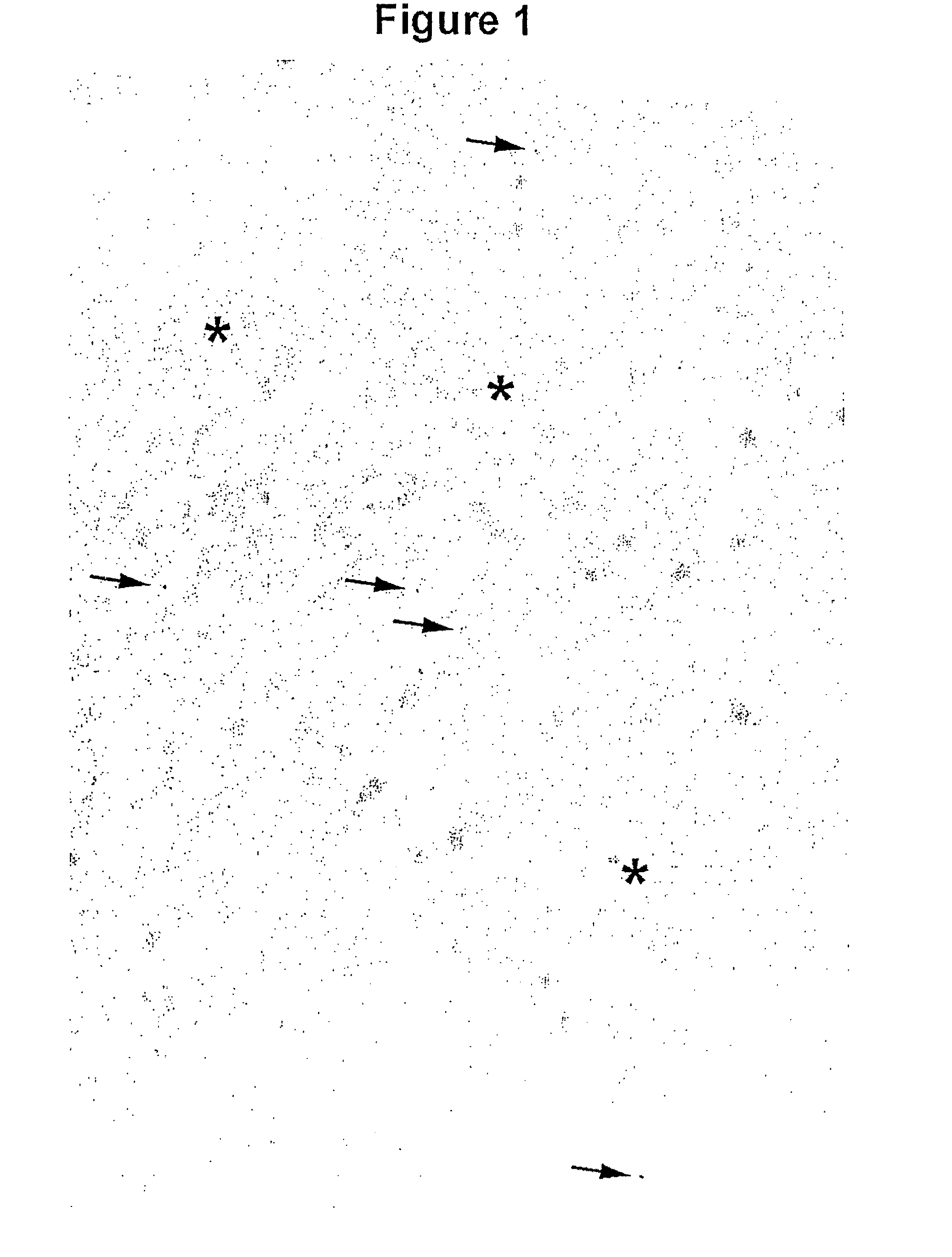 Method for isolation of soluble polypeptides