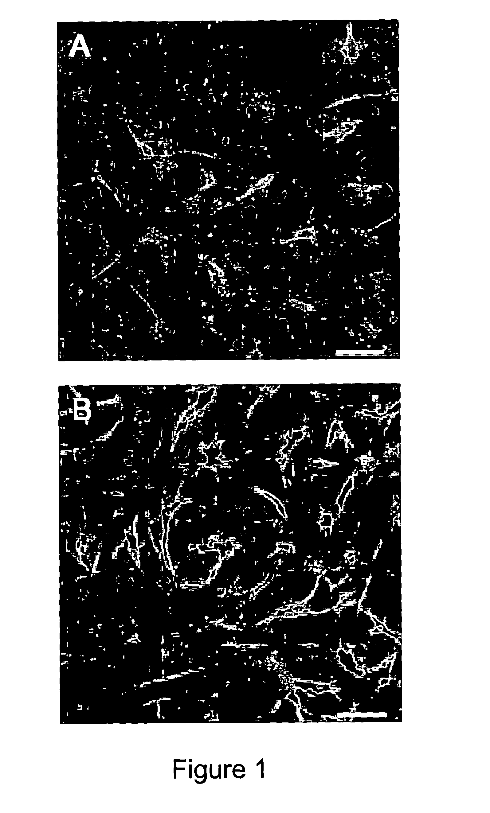 Oligodendrocyte Differentiation