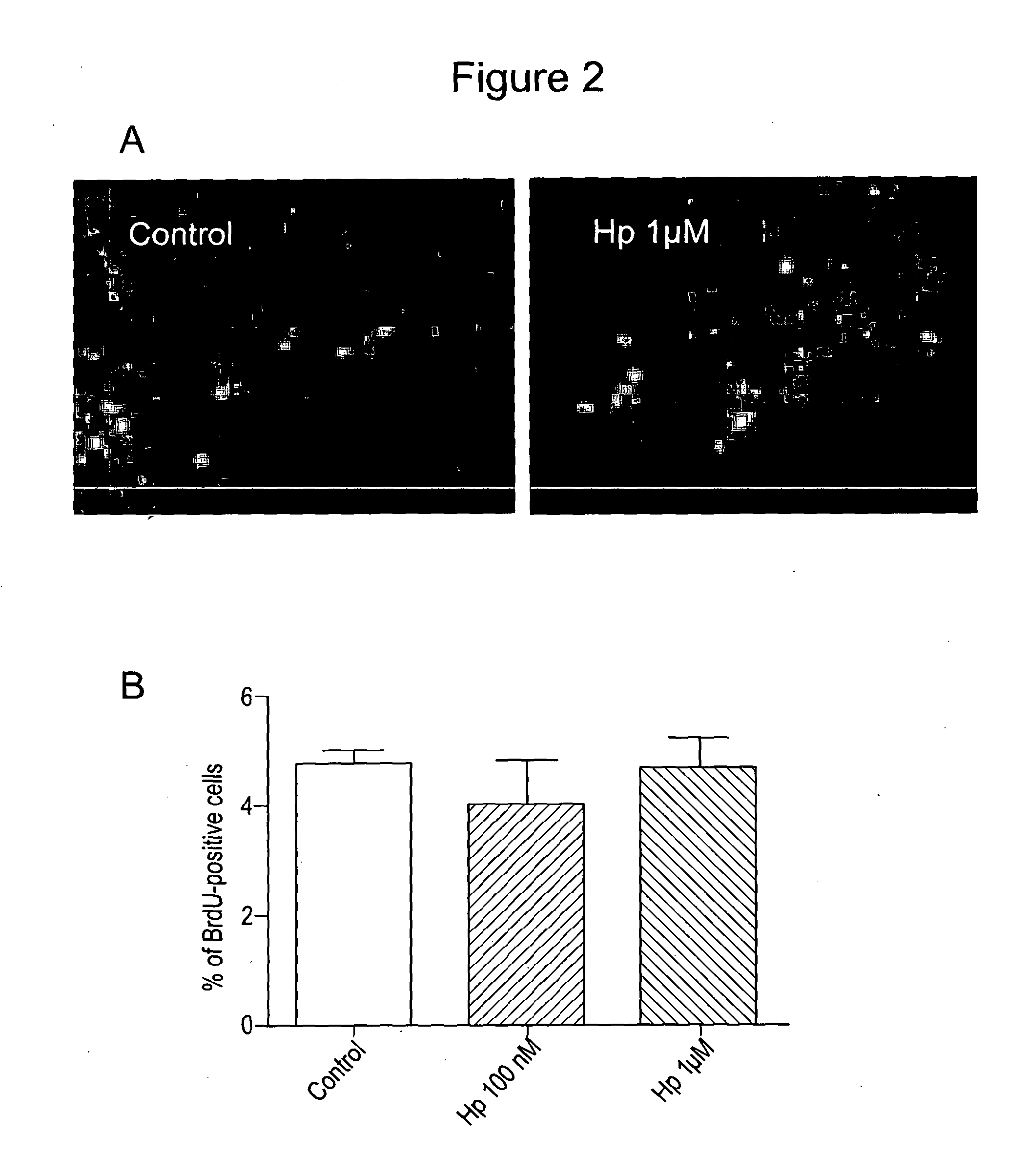 Oligodendrocyte Differentiation