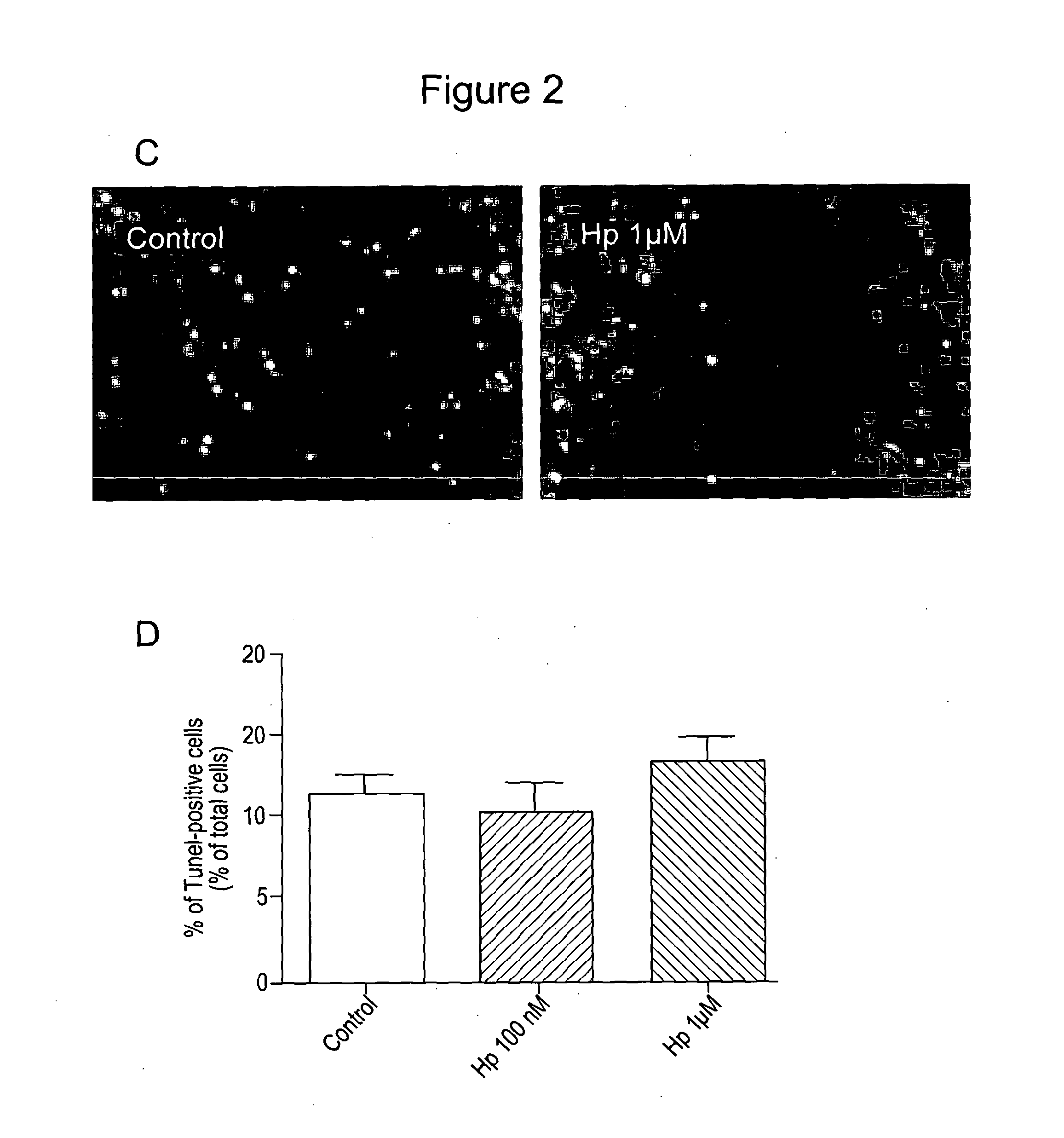 Oligodendrocyte Differentiation