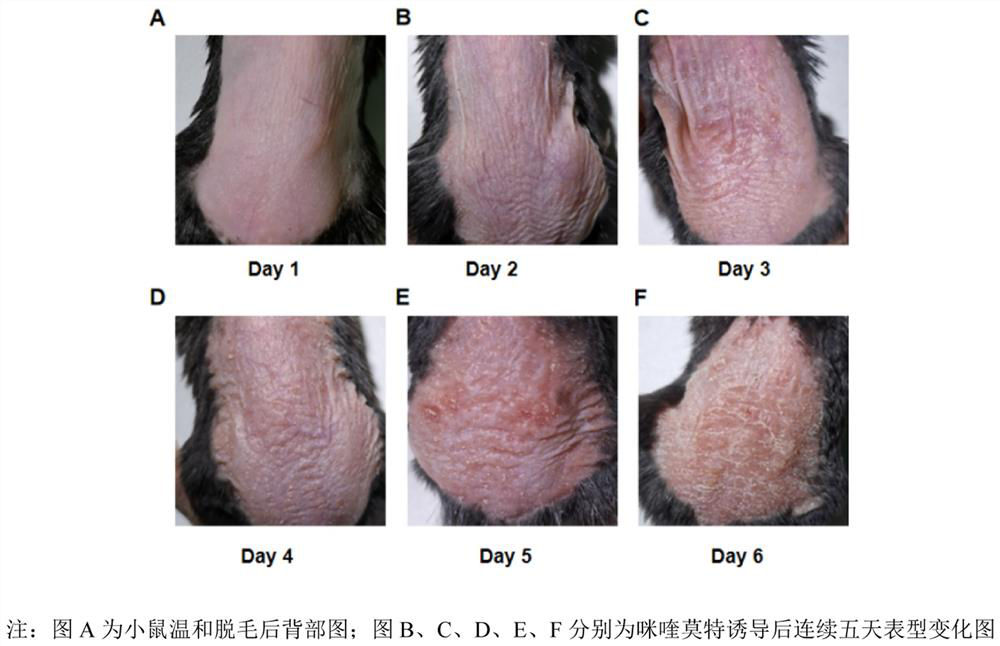 Non-diagnostic evaluation method after mouse back psoriasis model construction