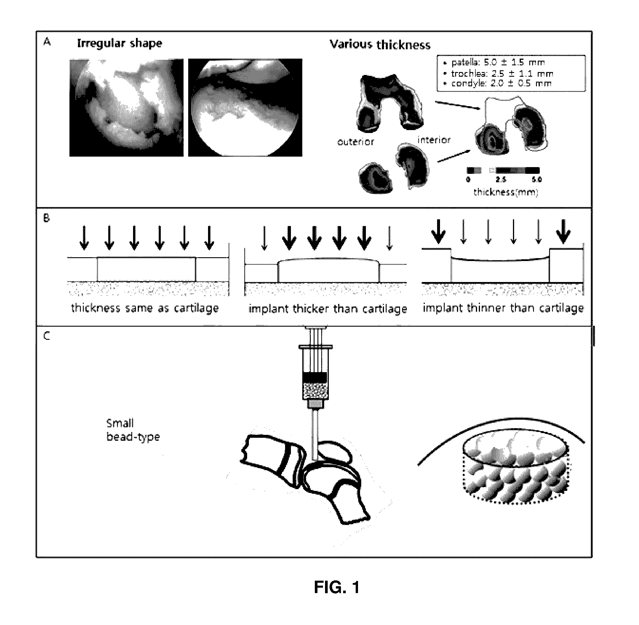 Preparation method for therapeutic agent of bead-type chondrocyte