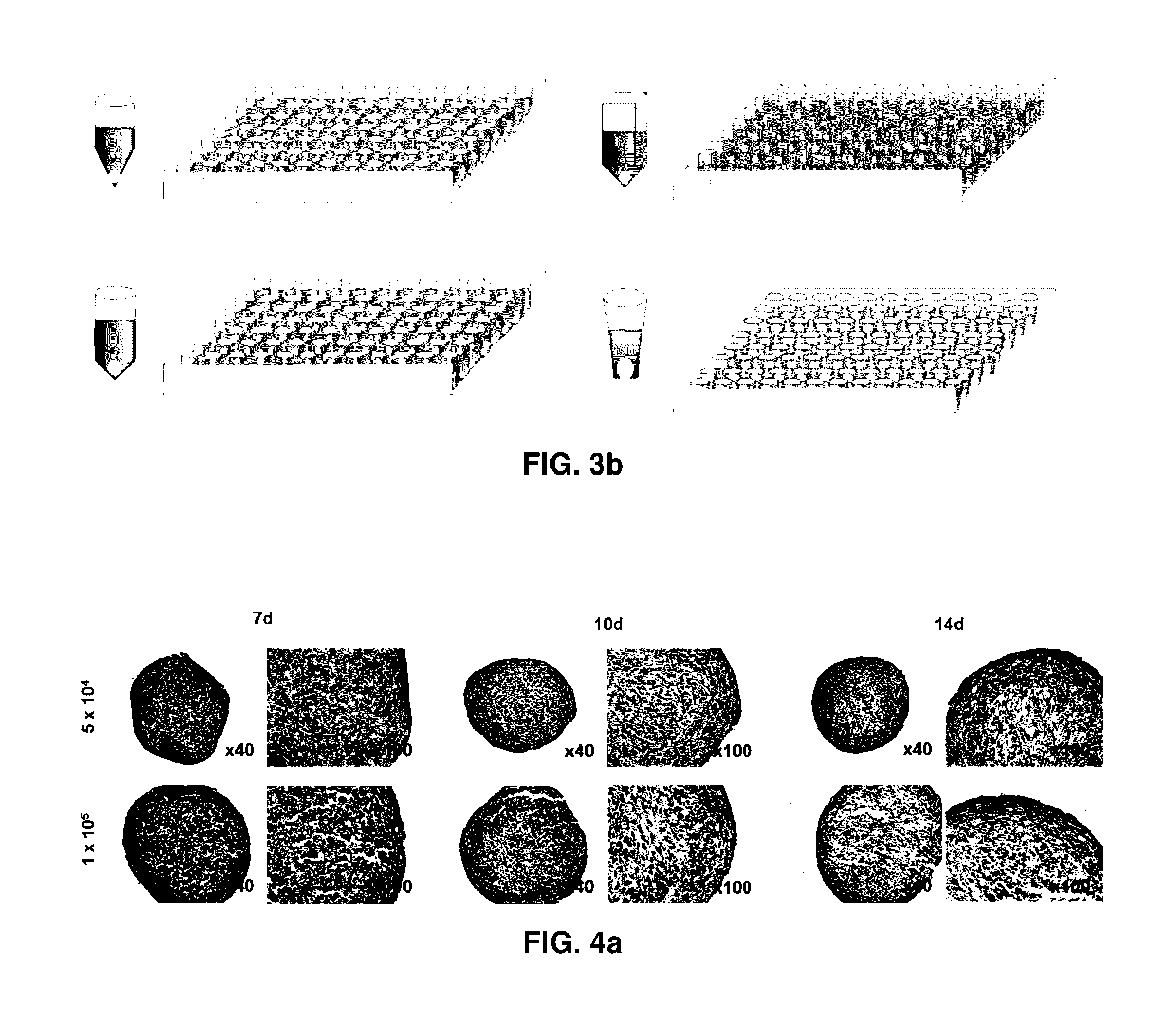 Preparation method for therapeutic agent of bead-type chondrocyte