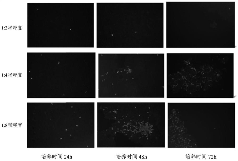 BRV serum neutralizing antibody titer level detection method based on IFA