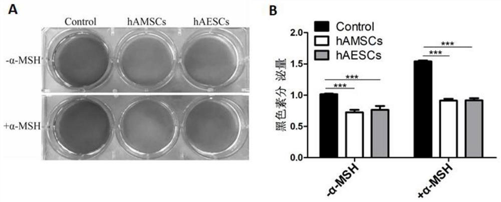 Preparation method and application of human amniotic stem cell culture