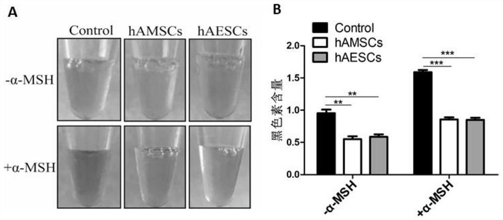 Preparation method and application of human amniotic stem cell culture