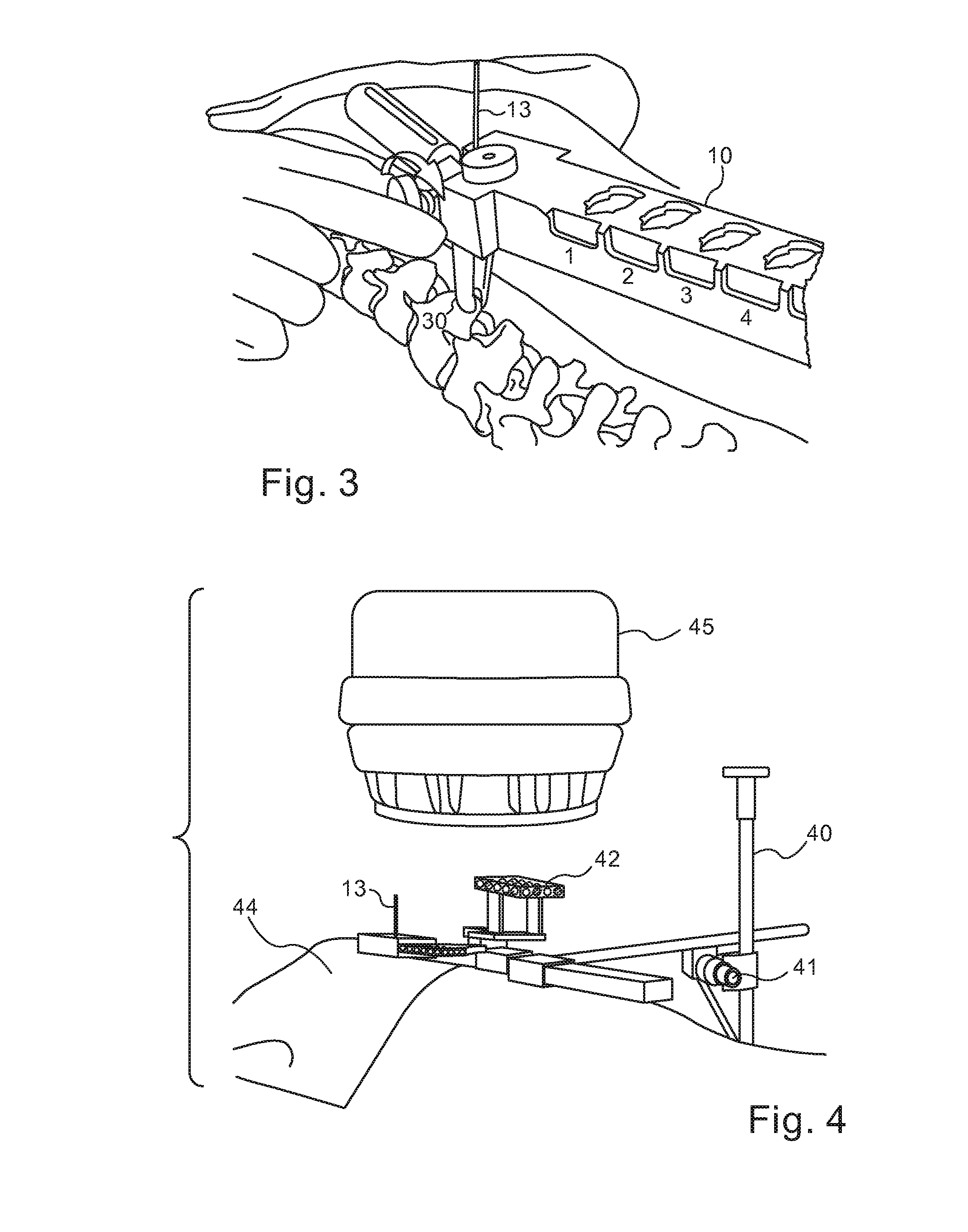 Robotic guided endoscope