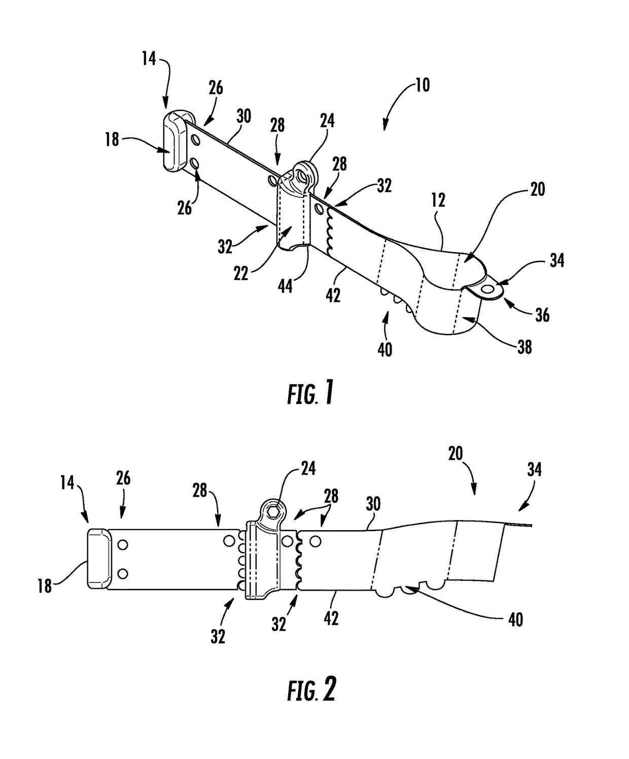 Circumferential matrix band