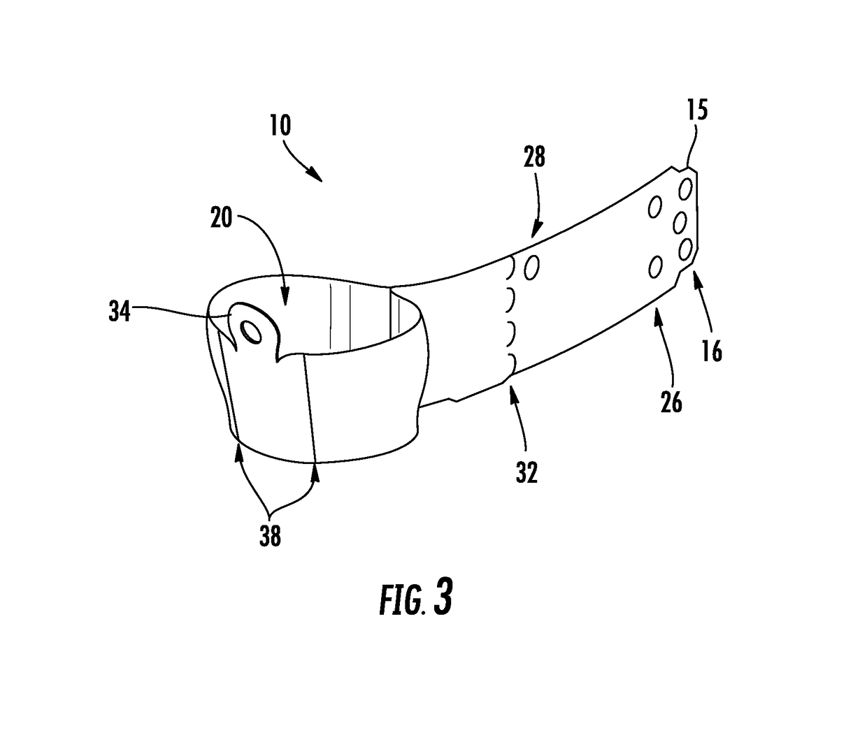 Circumferential matrix band