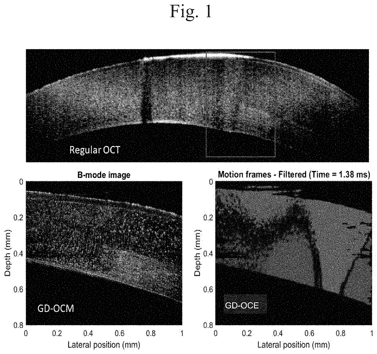 Gabor Domain Optical Coherence Elastography