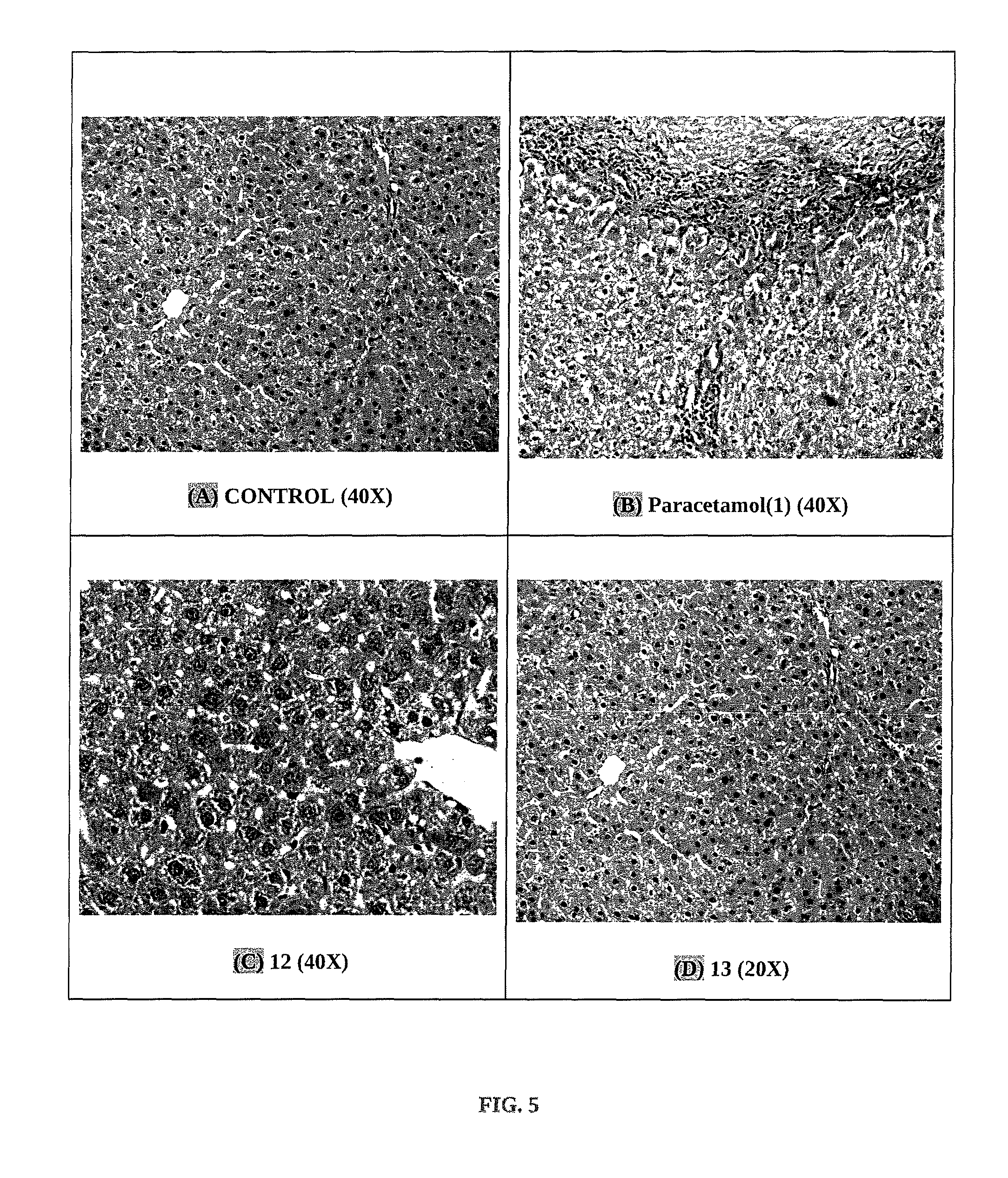 Nitric oxide releasing derivatives of paracetamol