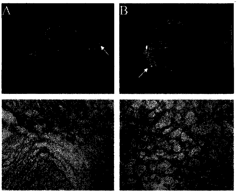 Magnetic resonance imaging contrast agent