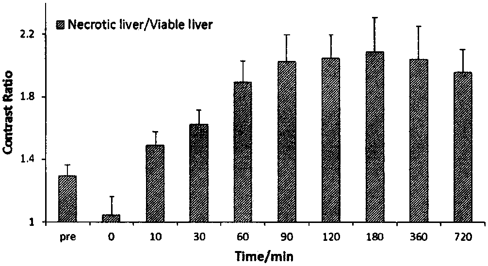 Magnetic resonance imaging contrast agent