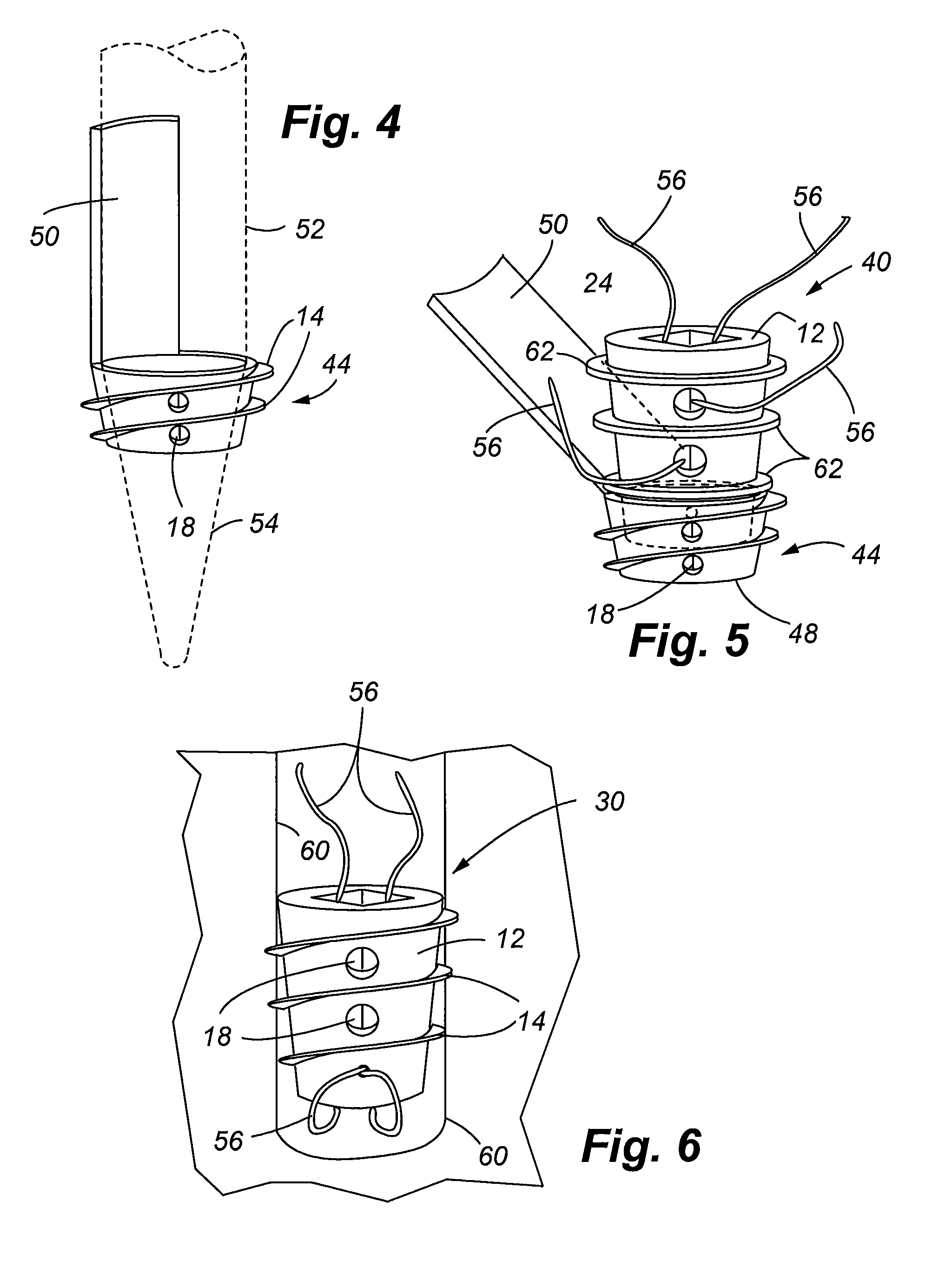 Bioelectric implant and method