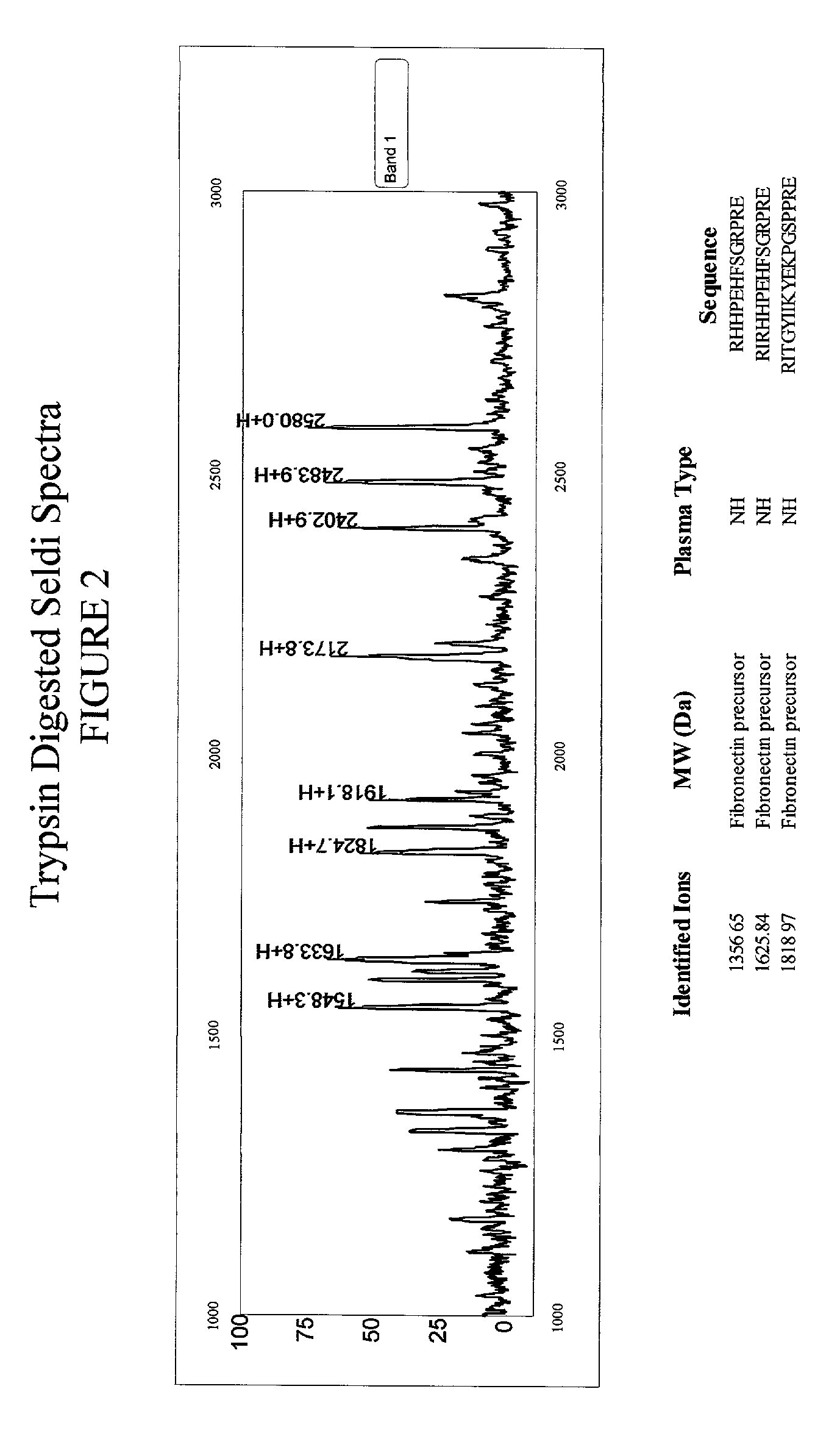 Fibronectin precursor biopolymer markers indicative of alzheimer's disease