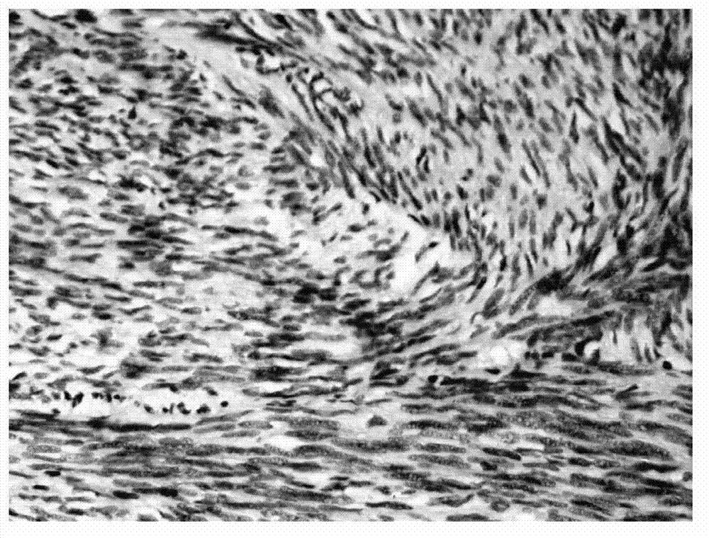 Application of DKK4 gene and coding protein thereof in preparation of medicament