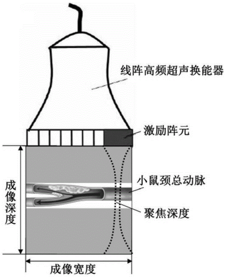 A Quantification and Extraction Method of Vessel Wall Image Texture Features