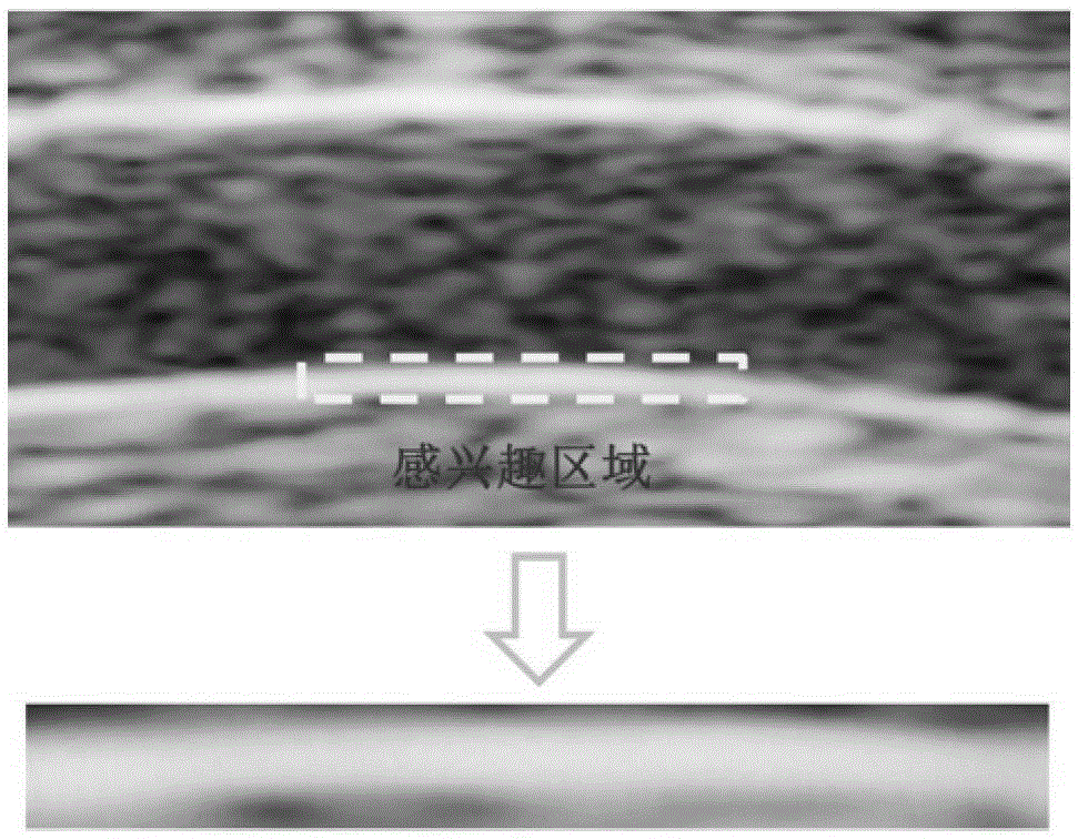 A Quantification and Extraction Method of Vessel Wall Image Texture Features