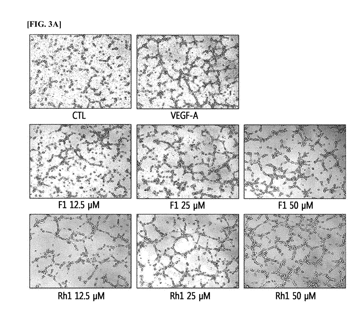 Composition for preventing or treating vascular leak syndrome