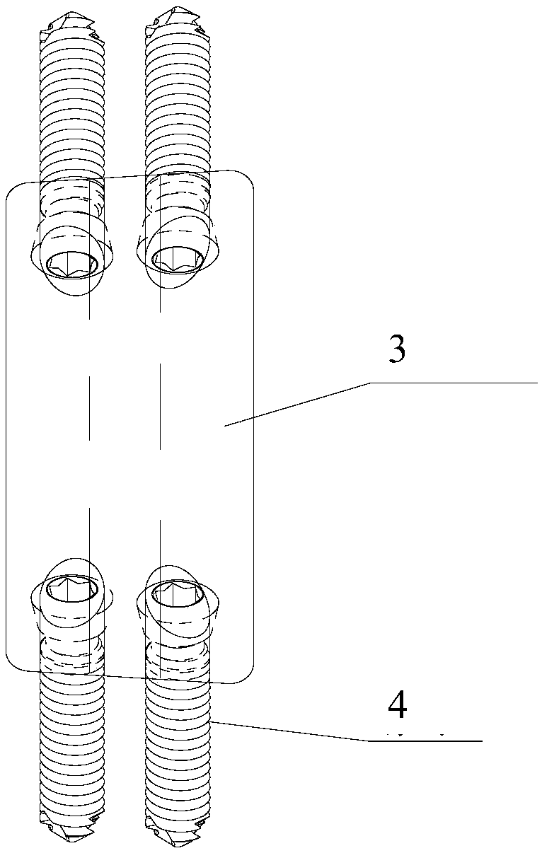 3D printing self-locking type anatomic artificial centrum and making process