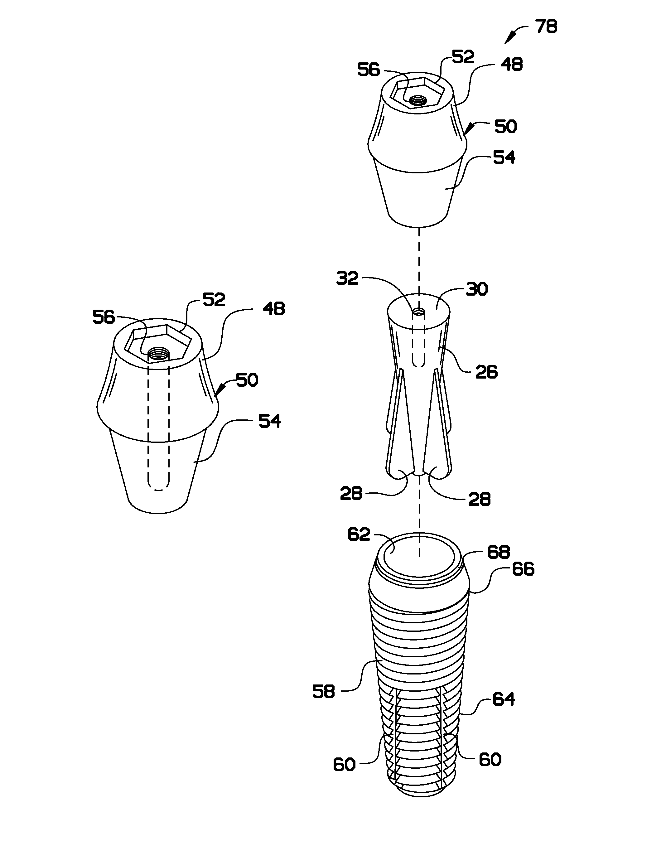 Dental implant system