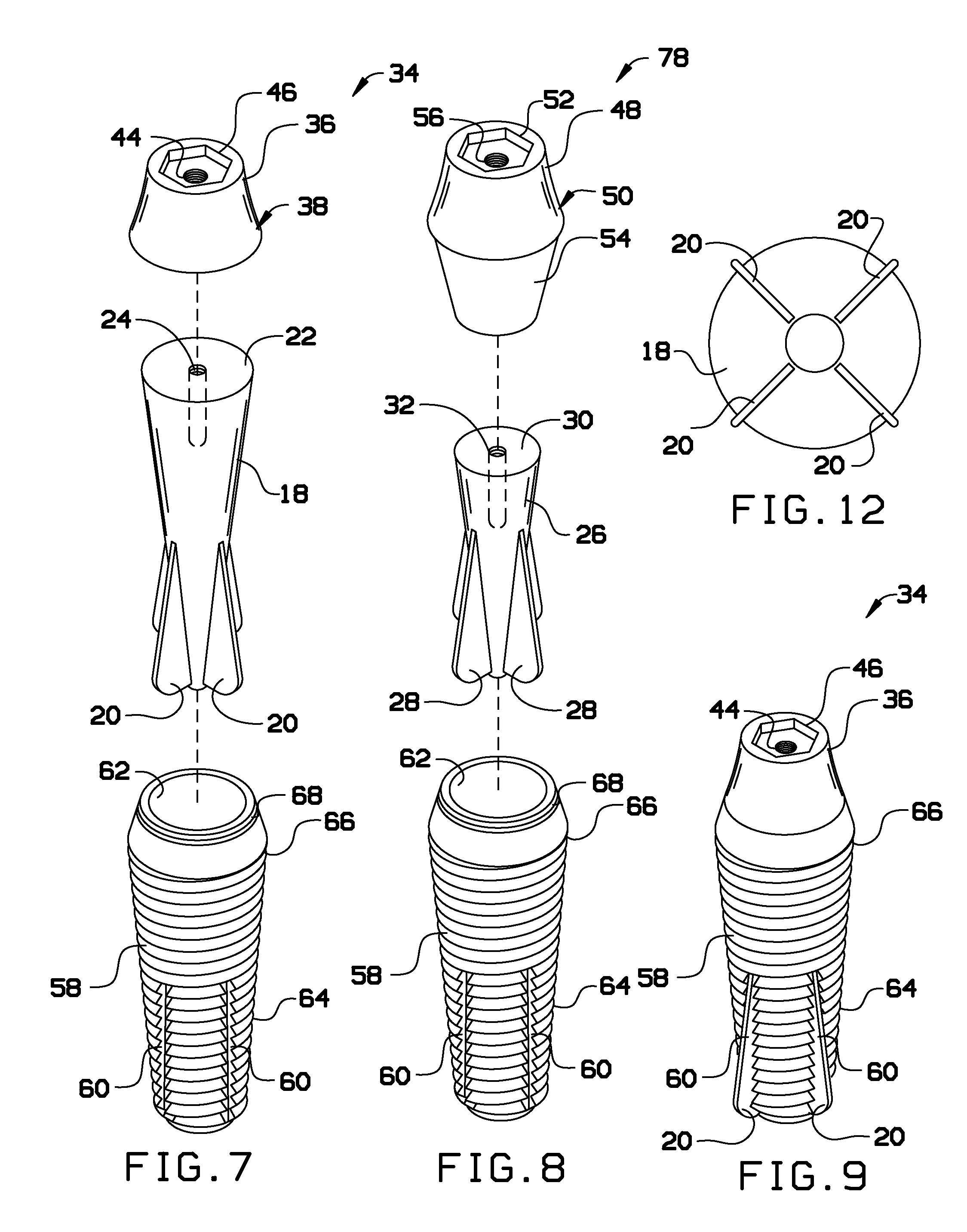 Dental implant system