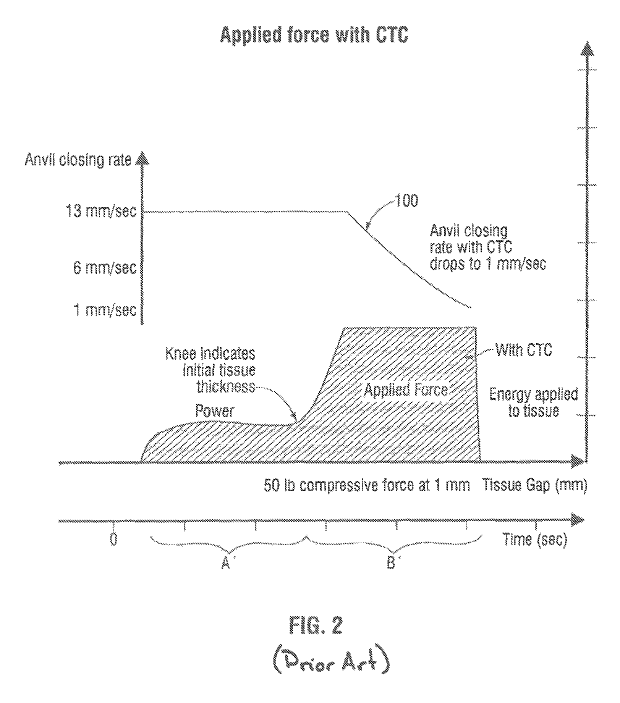 Surgical stapling apparatus employing a predictive stapling algorithm