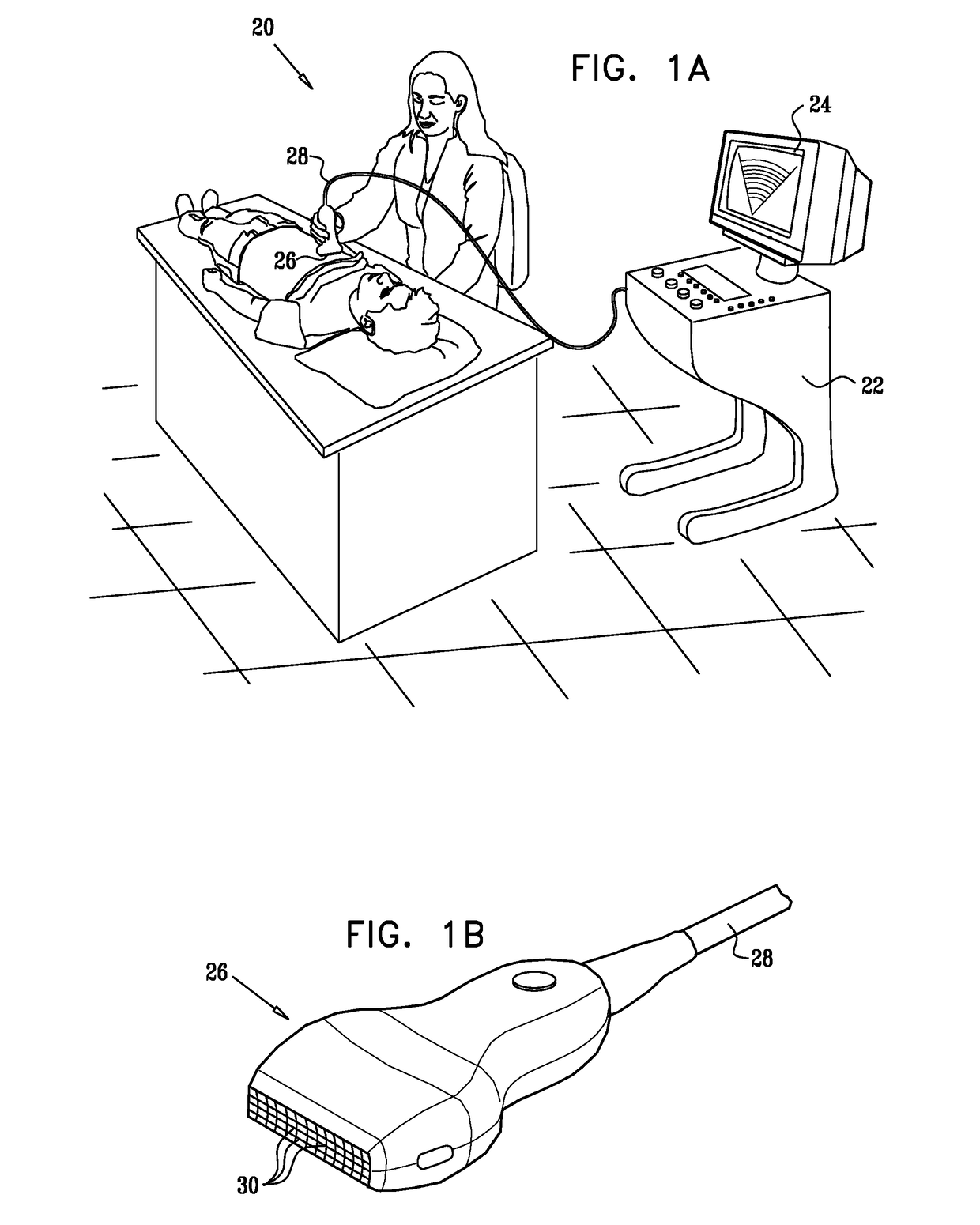 Clutter suppression in ultrasonic imaging systems