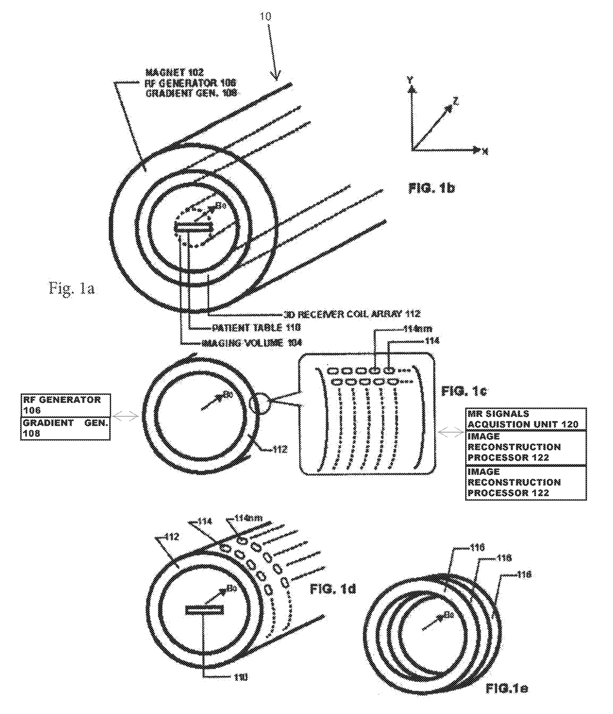 Ultrafast MRI system and method