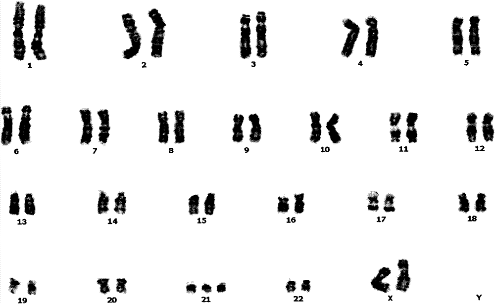 Culture apparatus special for in-situ culture of amniotic fluid/chorionic cells and application thereof