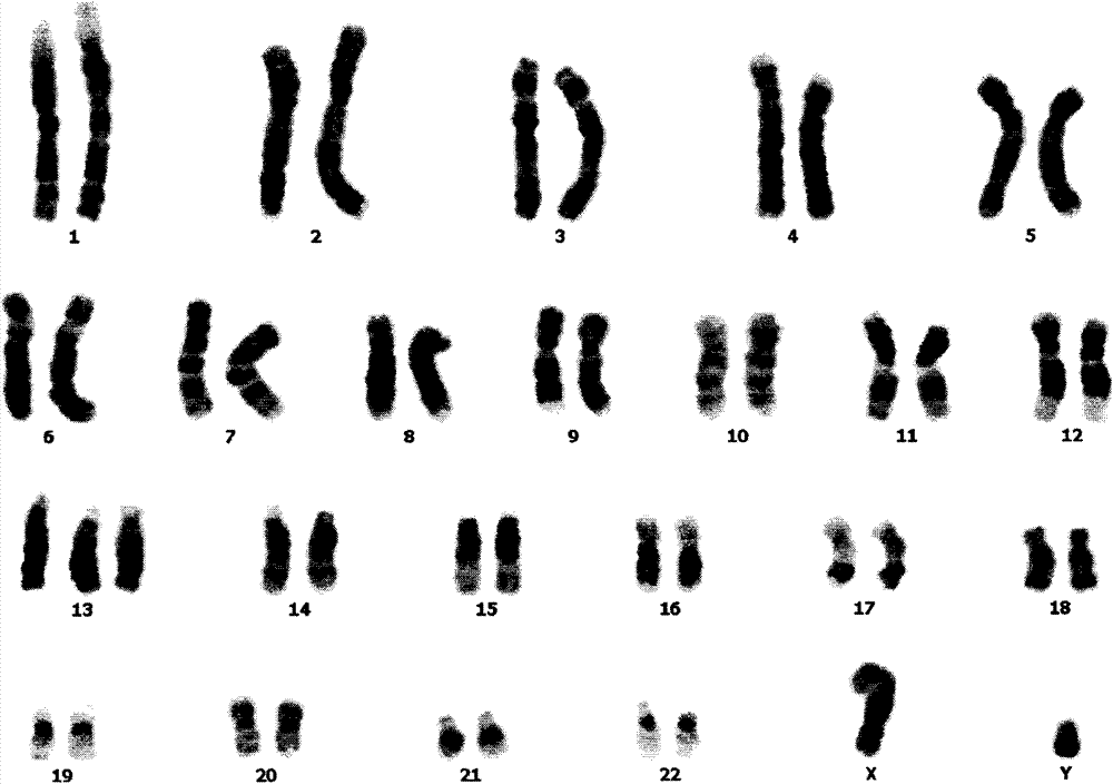 Culture apparatus special for in-situ culture of amniotic fluid/chorionic cells and application thereof