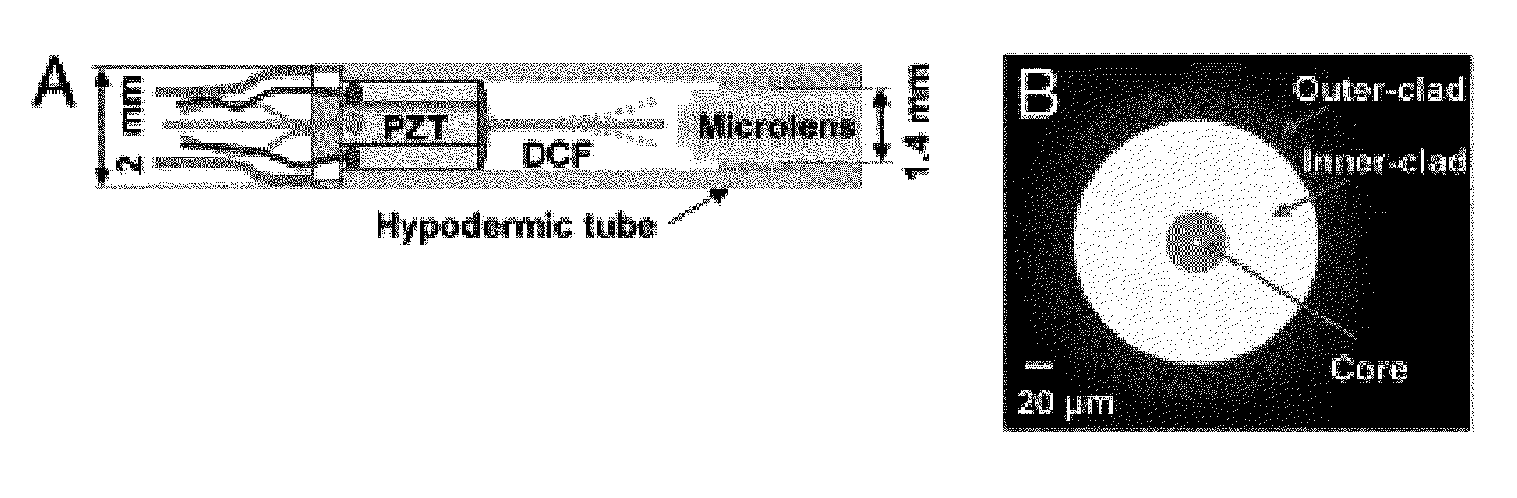 Method and system for assessing preterm birth and other pathologies