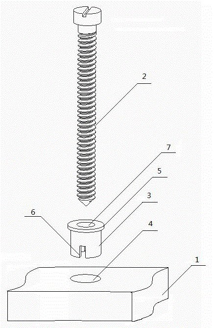 A bone fixation device composed of degradable bone plate and non-degradable bone nail