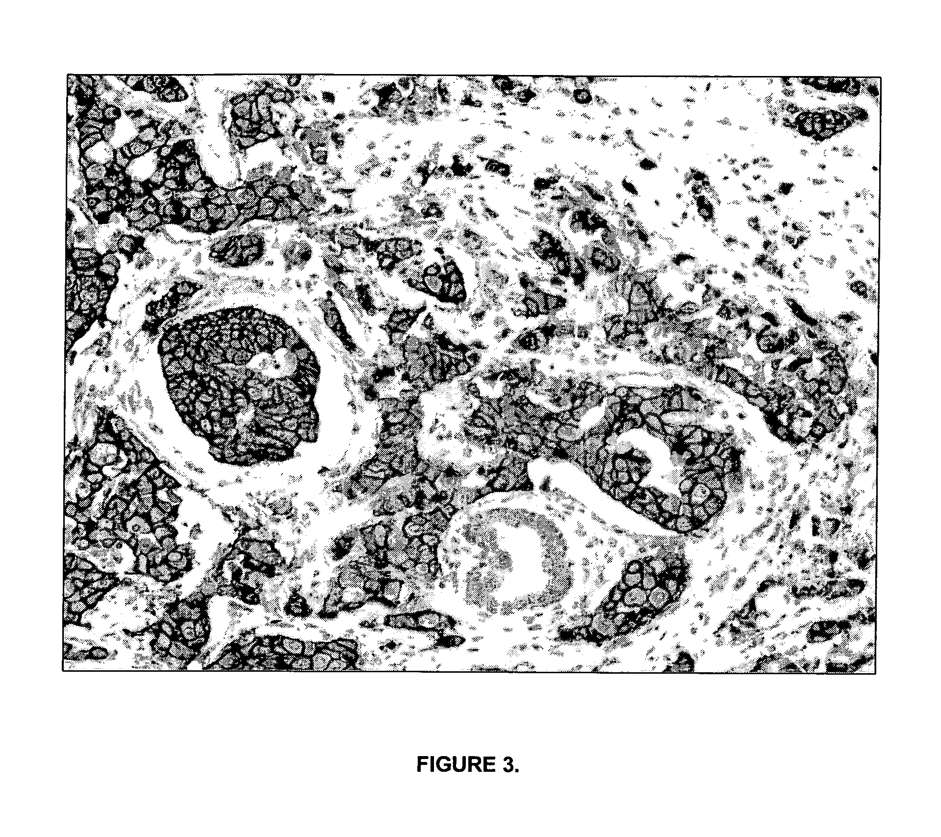 Methods, Reagents and Instrumentation for Preparing Impregnated Tissue Samples Suitable for Histopathological and Molecular Studies