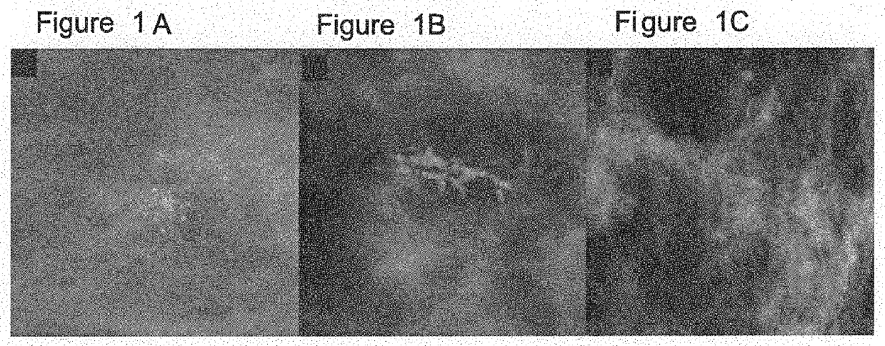 System, method and computer-accessible medium for classifying breast tissue using a convolutional neural network