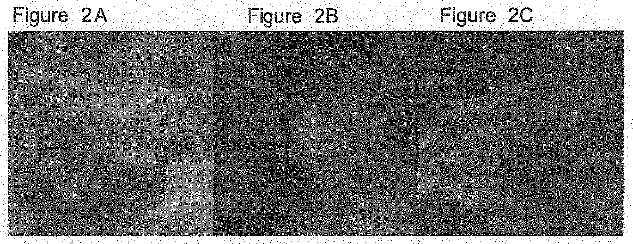 System, method and computer-accessible medium for classifying breast tissue using a convolutional neural network