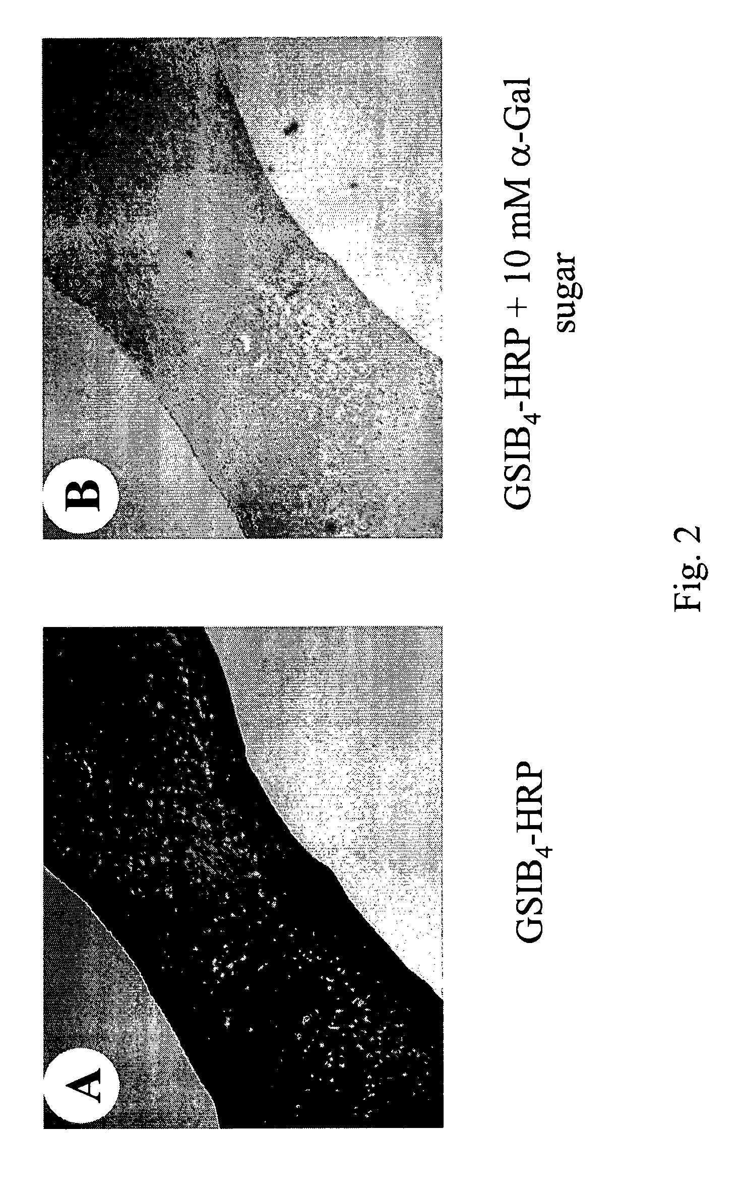 Genetically modified heart valve xenografts