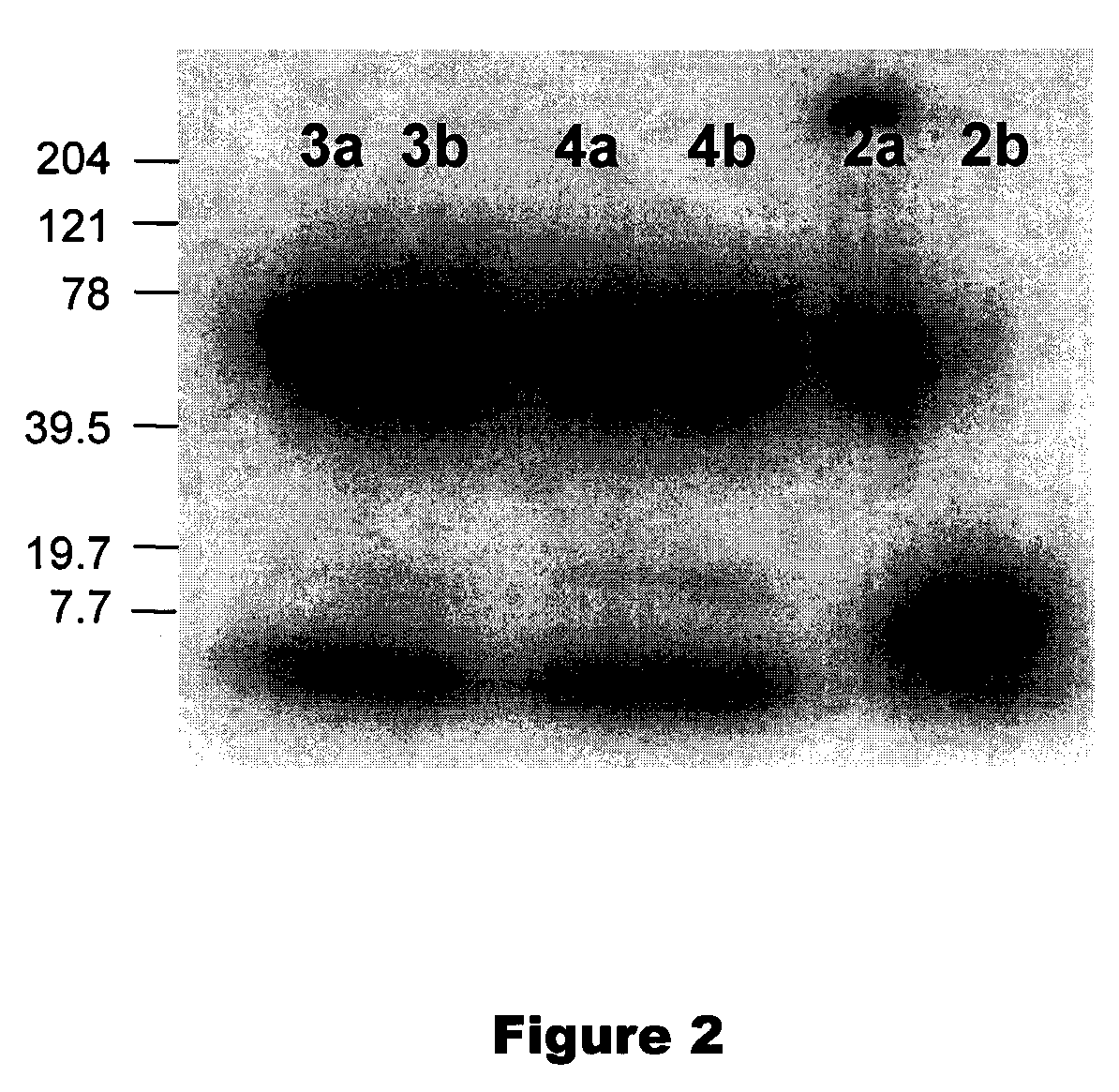 Radiologic Agents for Monitoring Alzheimer's Disease Progression and Evaluating a Response to Therapy and Processes for the Preparation of Such Agents