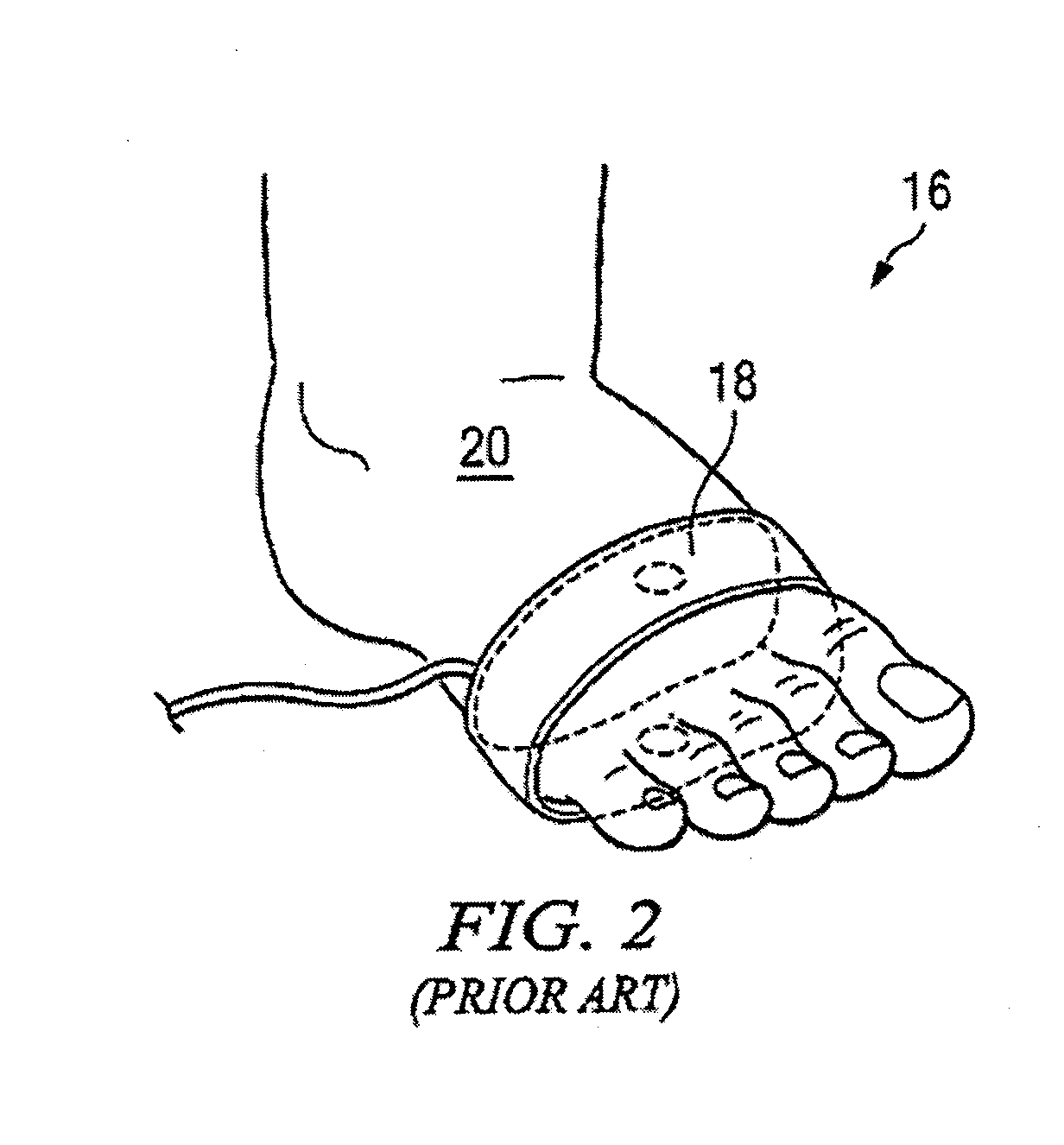 Pulse oximeter sleeve