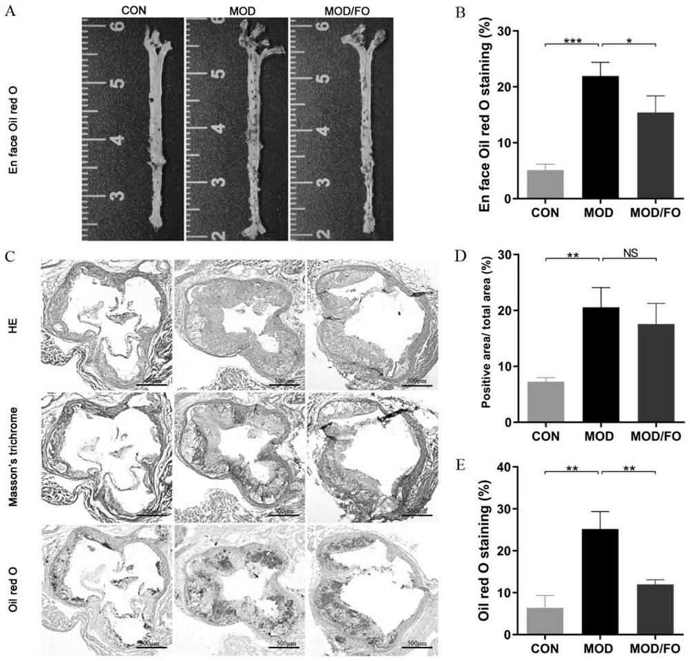 Application of linseed oil in preparation of medicine for improving atherosclerosis intestinal flora