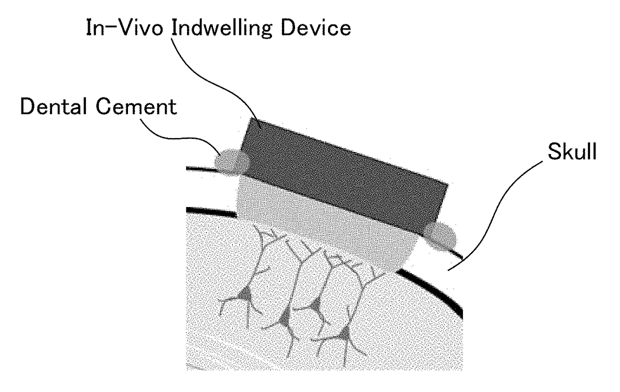 Translucent in-vivo indwelling device and utilization thereof