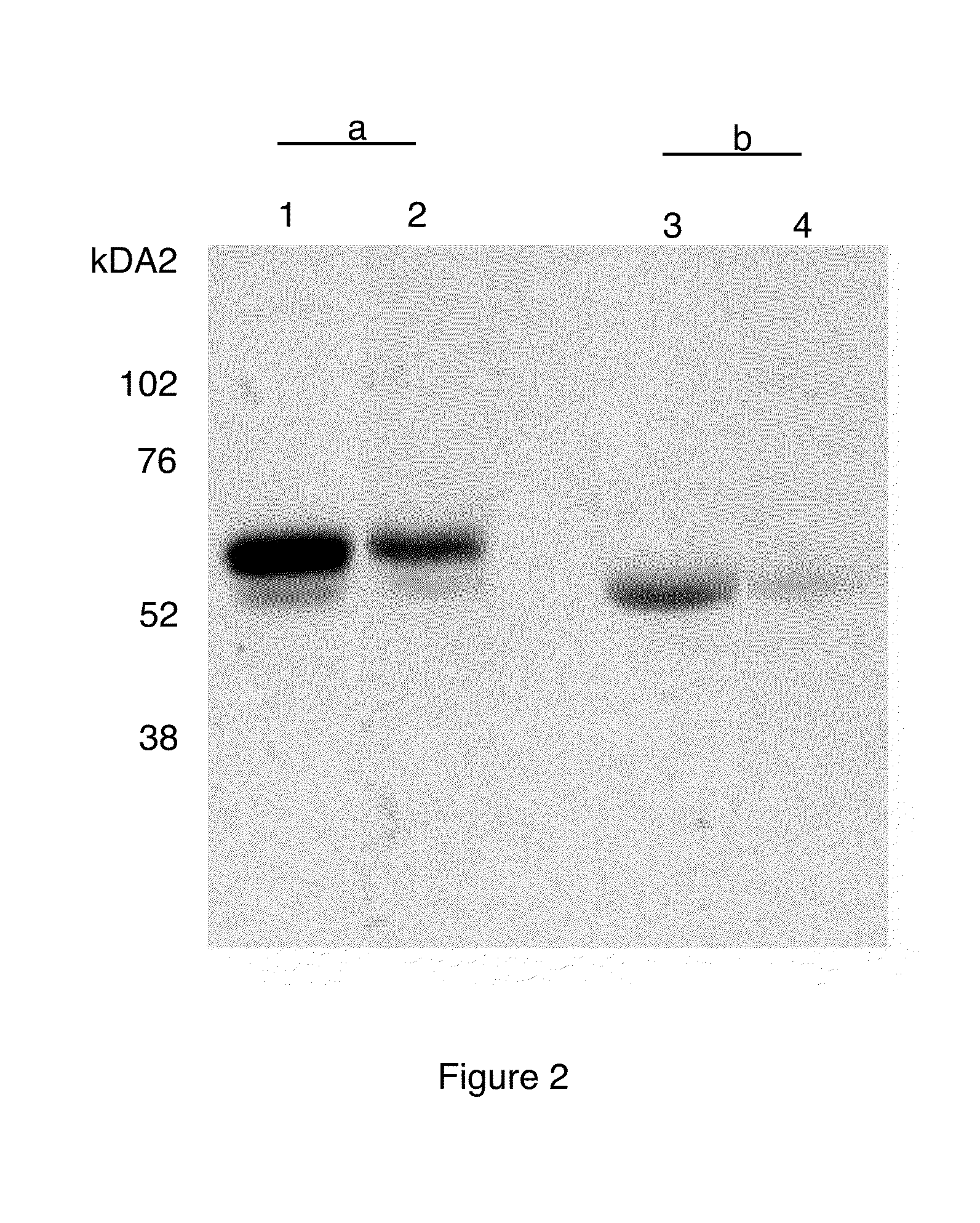 PIIINP Neo-epitope Assay