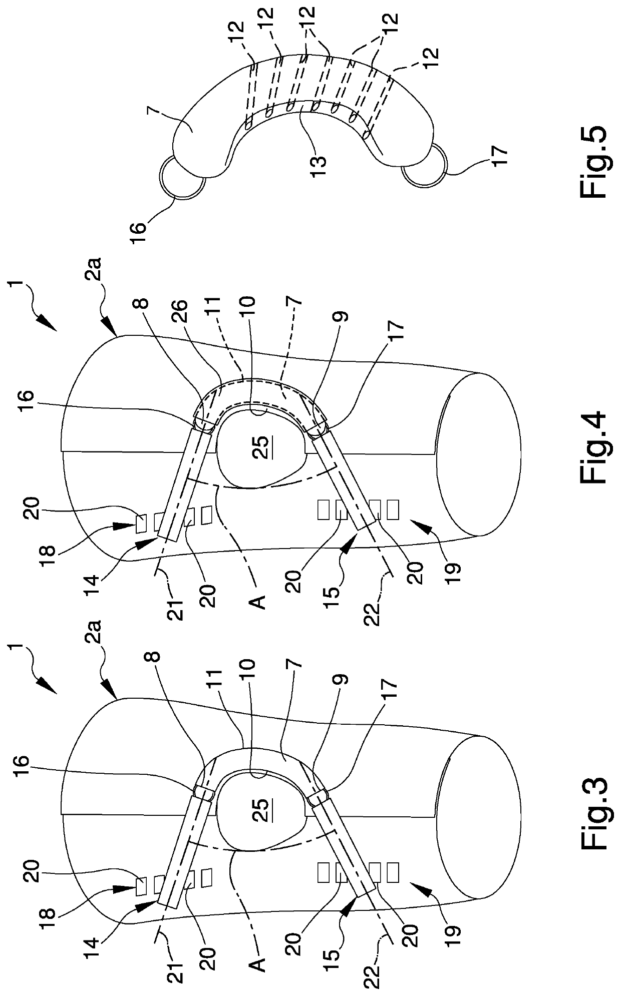 Joint stabilization device, particularly for the patellofemoral joint