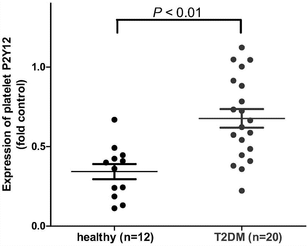 Biomarker for predicting II-type diabetic vascular complication risk and application thereof