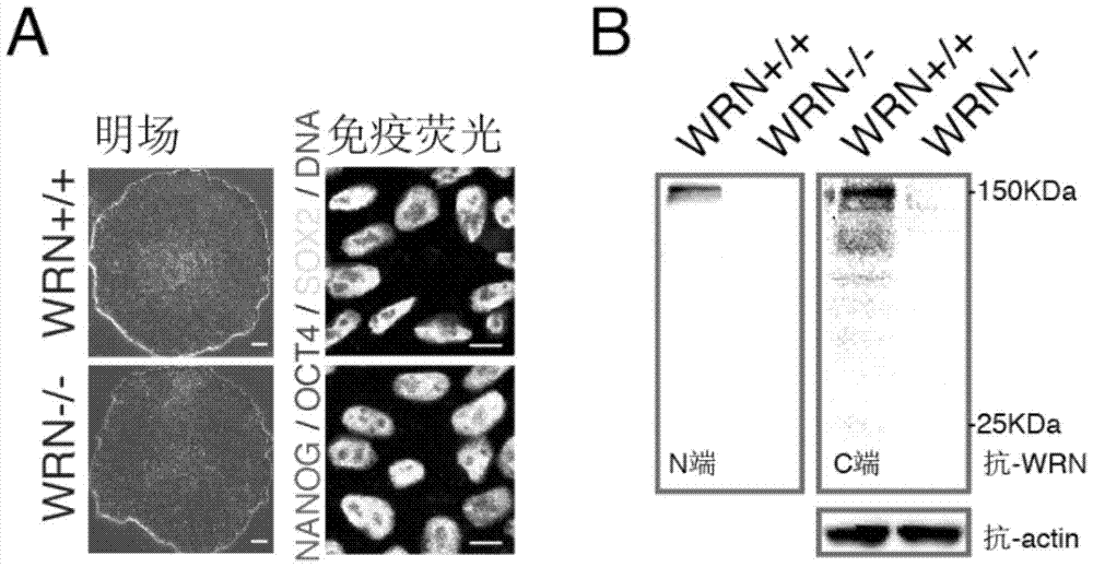 Pluripotent stem cells carrying human progeria gene mutation and preparation method thereof