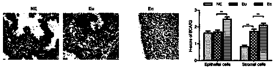 Endometriosis diagnosis and prognosis marker and application thereof