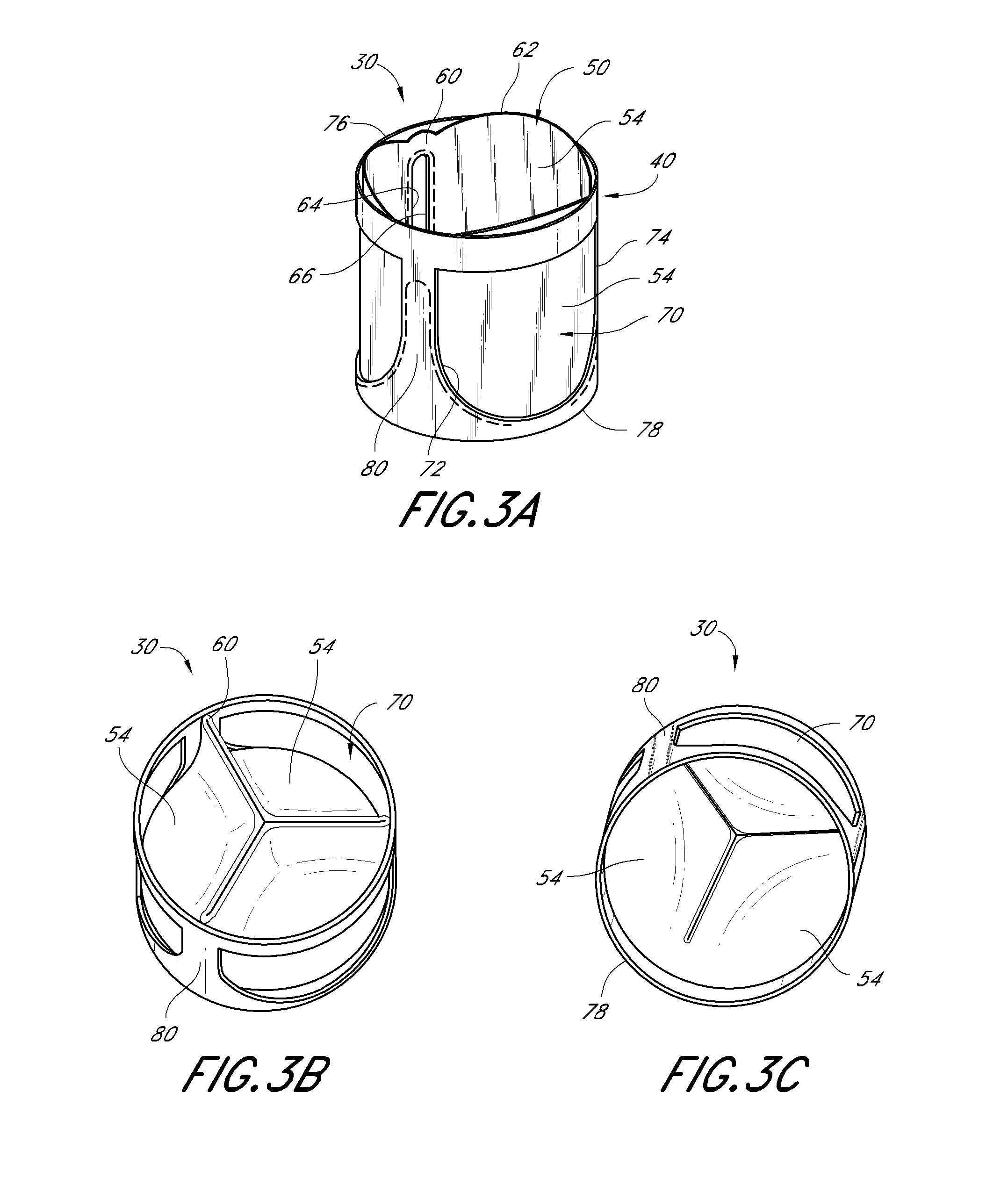 Replacement heart valve and method